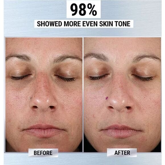 Kiehl's Cleary Corrective Dark Spot Solution Duo - Picture 10 of 11